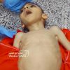 استشهاد طفل جديد في غزة بسبب المجاعة 